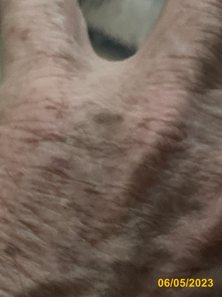 0013