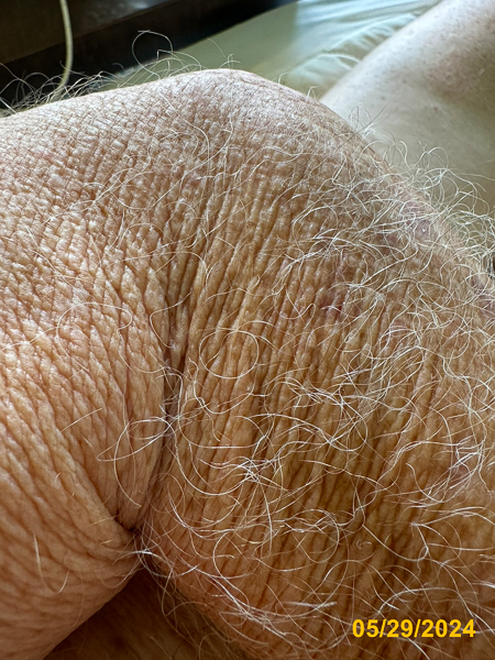 0364