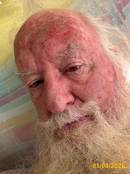 0024